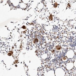 MTMR11 Antibody, Novus Biologicals:Antibodies:Primary Antibodies