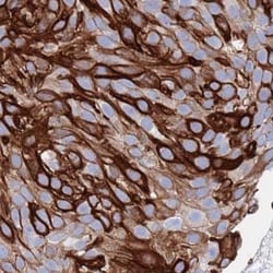MTMR2 Antibody, Novus Biologicals:Antibodies:Primary Antibodies