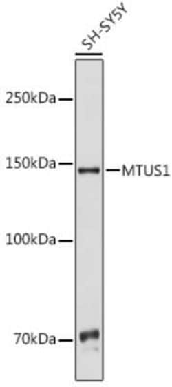 MTUS1 Rabbit anti-Human, Polyclonal, Novus Biologicals 100 &mu;g; Unconjugated:Antibodies,