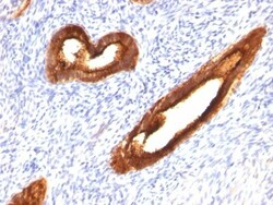 MUC1 Antibody (MUC1/520), Novus Biologicals 0.2mg; Unlabeled:Antibodies,