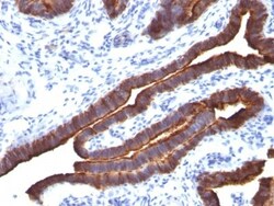 MUC1 Antibody (MUC1/520), Novus Biologicals 0.2mg; Unlabeled:Antibodies,