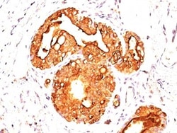 MUC1 Antibody (MUC1/845), Novus Biologicals 0.2mg; Unlabeled:Antibodies,