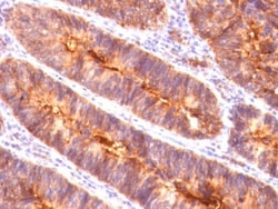 MUC1 Antibody (MUC1/845), Novus Biologicals 0.2mg; Unlabeled:Antibodies,