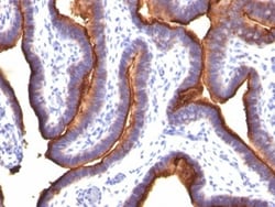 MUC1 Antibody (MUC1/845), Novus Biologicals 0.2mg; Unlabeled:Antibodies,