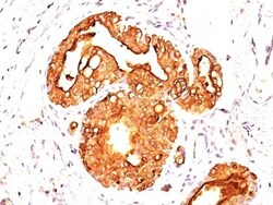MUC1 Antibody (MUC1/955), Novus Biologicals 0.2mg; Unlabeled:Antibodies,