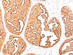MUC1 Antibody (MUC1/967), Novus Biologicals 0.2mg; Unlabeled:Antibodies,