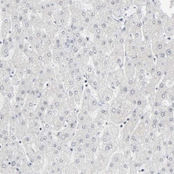 MUC1 Antibody, Novus Biologicals 25 &mu;L | Buy Online | Novus Biologicals | Fisher Scientific