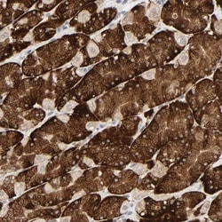 MUC1 Antibody, Novus Biologicals 25 &mu;L | Buy Online | Novus Biologicals | Fisher Scientific