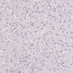 MUC12 Antibody, Novus Biologicals 25 &mu;L | Buy Online | Novus Biologicals | Fisher Scientific