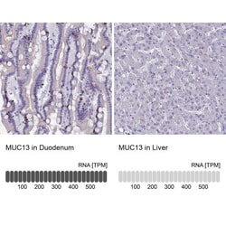 MUC13 Antibody, Novus Biologicals 25 &mu;L, Unconjugated:Antibodies, Polyclonal