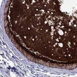 MUC15 Rabbit anti-Human, Polyclonal, Novus Biologicals 25 &mu;g | Buy Online | Novus Biologicals | Fisher Scientific