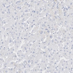MUC17 Antibody, Novus Biologicals 25 &mu;L | Buy Online | Novus Biologicals | Fisher Scientific