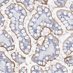 MUC17 Antibody, Novus Biologicals 25 &mu;L | Buy Online | Novus Biologicals | Fisher Scientific