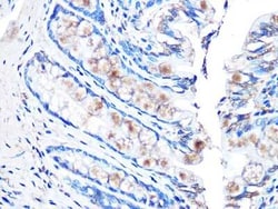 MUC2 Rabbit anti-Human, Mouse, Rat, Clone: 4L5Y8, Novus Biologicals:Antibodies:Primary