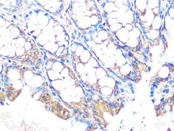 MUC2 Rabbit anti-Human, Mouse, Rat, Clone: 4L5Y8, Novus Biologicals:Antibodies:Primary