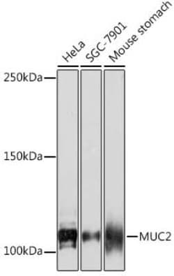 MUC2 Rabbit anti-Human, Mouse, Rat, Clone: 4L5Y8, Novus Biologicals:Antibodies:Primary