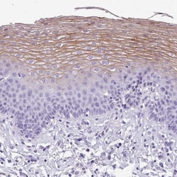 MUC21 Antibody, Novus Biologicals:Antibodies:Primary Antibodies