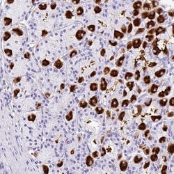 MUC21 Antibody, Novus Biologicals:Antibodies:Primary Antibodies