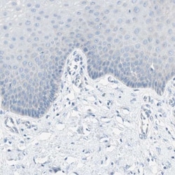 MUCDHL Antibody, Novus Biologicals 25 &mu;L, Unconjugated:Antibodies, Polyclonal