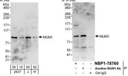 MUM1 Antibody, Novus Biologicals 0.1mg; Unlabeled:Antibodies, Polyclonal