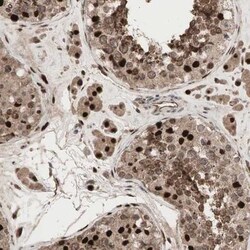 MUM1L1 Antibody, Novus Biologicals 25 &mu;L; Unlabeled:Antibodies, Polyclonal