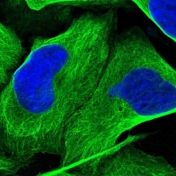 Desmoglein-2 Antibody, Novus Biologicals:Antibodies:Primary Antibodies
