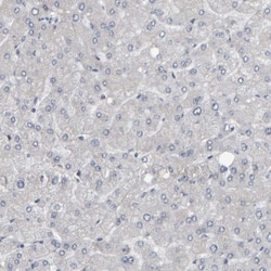 Desmoglein-2 Antibody, Novus Biologicals:Antibodies:Primary Antibodies