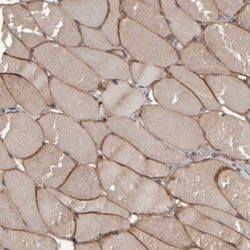 Desmoglein-2 Antibody, Novus Biologicals:Antibodies:Primary Antibodies