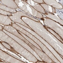 Desmocollin-2 Antibody, Novus Biologicals:Antibodies:Primary Antibodies