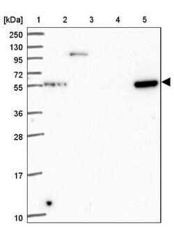 MURF2 Antibody, Novus Biologicals 25 &mu;L | Buy Online | Novus Biologicals | Fisher Scientific