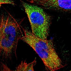 MVP Antibody, Novus Biologicals 0.1mL; Unlabeled:Antibodies, Polyclonal