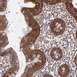 MVP Antibody, Novus Biologicals 0.1mL; Unlabeled:Antibodies, Polyclonal