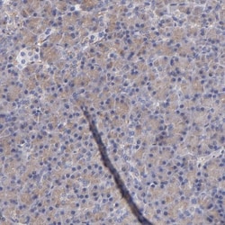 MVP Antibody, Novus Biologicals 0.1mL; Unlabeled:Antibodies, Polyclonal