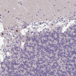 MXRA8/DICAM Antibody, Novus Biologicals 0.1mL; Unlabeled:Antibodies, Polyclonal