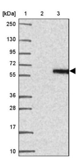 MXRA8/DICAM Antibody, Novus Biologicals 0.1mL; Unlabeled:Antibodies, Polyclonal
