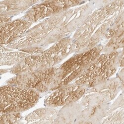 HOMER2 Antibody, Novus Biologicals:Antibodies:Primary Antibodies
