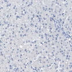 MYBPC1 Antibody, Novus Biologicals 0.1mL; Unlabeled:Antibodies, Polyclonal