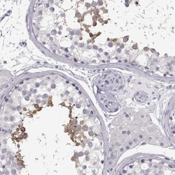MYCBPAP Antibody, Novus Biologicals:Antibodies:Primary Antibodies