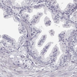 MYCBPAP Antibody, Novus Biologicals:Antibodies:Primary Antibodies