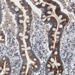 MYH Antibody, Novus Biologicals 25 &mu;L | Buy Online | Novus Biologicals | Fisher Scientific