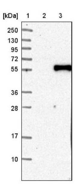 MYH Antibody, Novus Biologicals 25 &mu;L | Buy Online | Novus Biologicals | Fisher Scientific