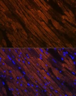 MYH6/7 Rabbit anti-Mouse, Rat, Clone: 6V0G1, Novus Biologicals 20 &mu;g;