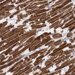 MYH6 Antibody (CL2148), Novus Biologicals:Antibodies:Primary Antibodies