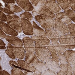 MYH6 Antibody (CL2148), Novus Biologicals:Antibodies:Primary Antibodies