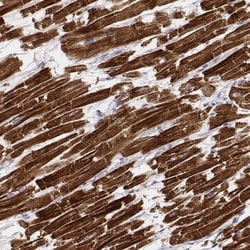 MYH6 Antibody (CL2155), Novus Biologicals:Antibodies:Primary Antibodies