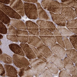 MYH6 Antibody (CL2155), Novus Biologicals:Antibodies:Primary Antibodies