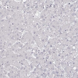 MYH6 Antibody (CL2155), Novus Biologicals:Antibodies:Primary Antibodies