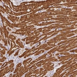 MYL4 Antibody, Novus Biologicals 0.1mL; Unlabeled:Antibodies, Polyclonal