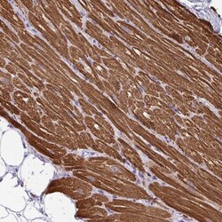 MYL7 Antibody, Novus Biologicals 25 &mu;L; Unlabeled:Antibodies, Polyclonal