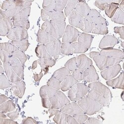 MYL7 Antibody, Novus Biologicals 25 &mu;L; Unlabeled:Antibodies, Polyclonal